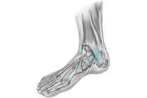 QUOLE for men orthopedie voor voetklachten